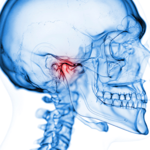 radiografia de una mandibula