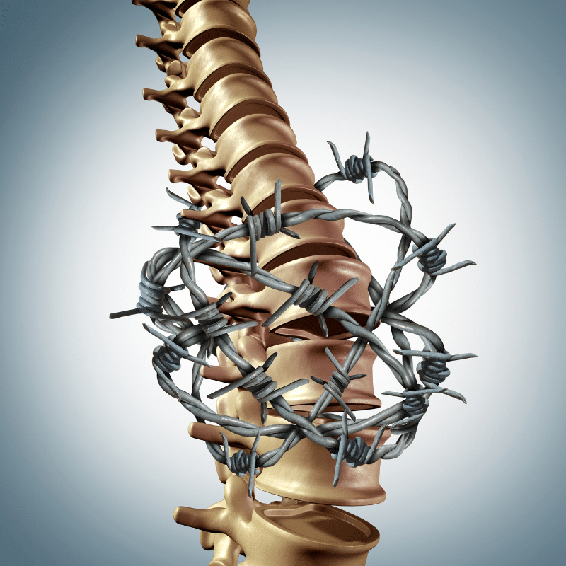 Desenredando el dolor lumbar