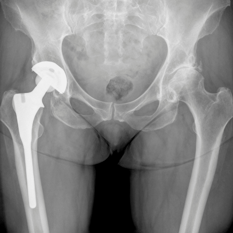 radiografia de las piernas de un paciente