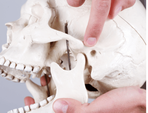 Todo lo que necesitas saber sobre el compromiso de la articulación temporomandibular (CAT)