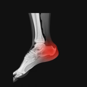 radiografia de pie